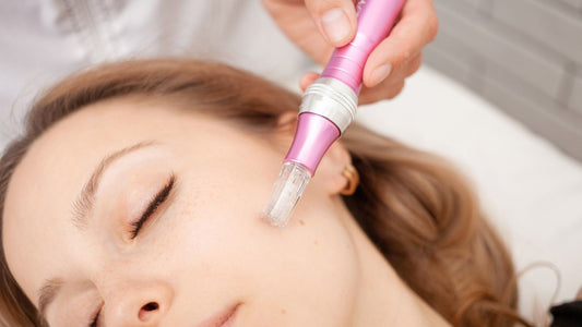Tratamientos con microneedling