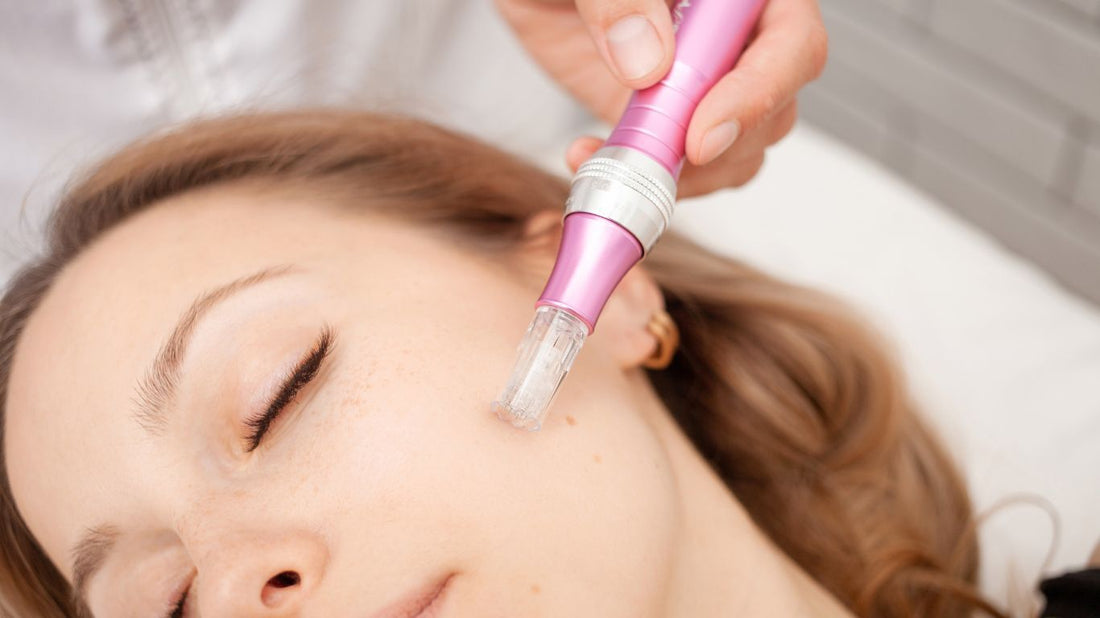 Tratamientos con microneedling
